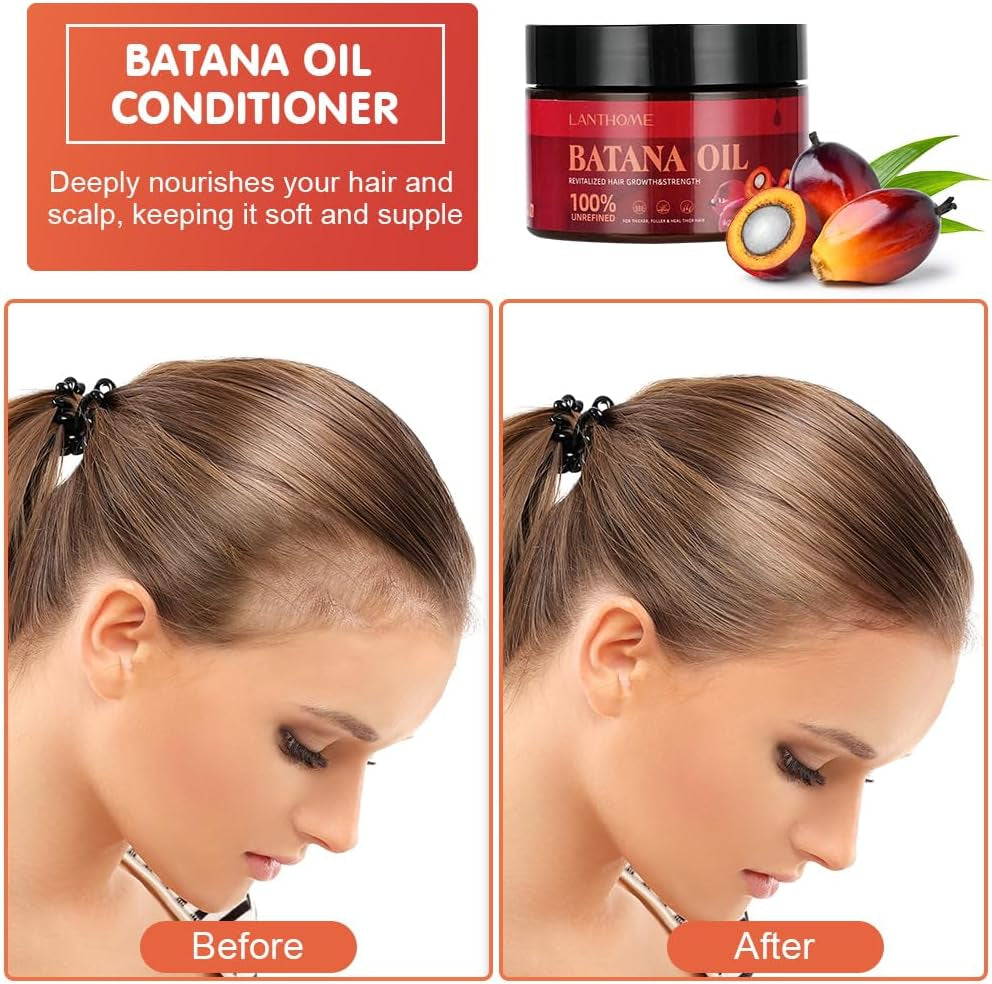 Raw Batana Oil, 120ML Pure & Natural for Hair Growth, Healthier, Thicker, Fuller Hair, Eliminates Split Ends, Repairs Damage for Men & Women